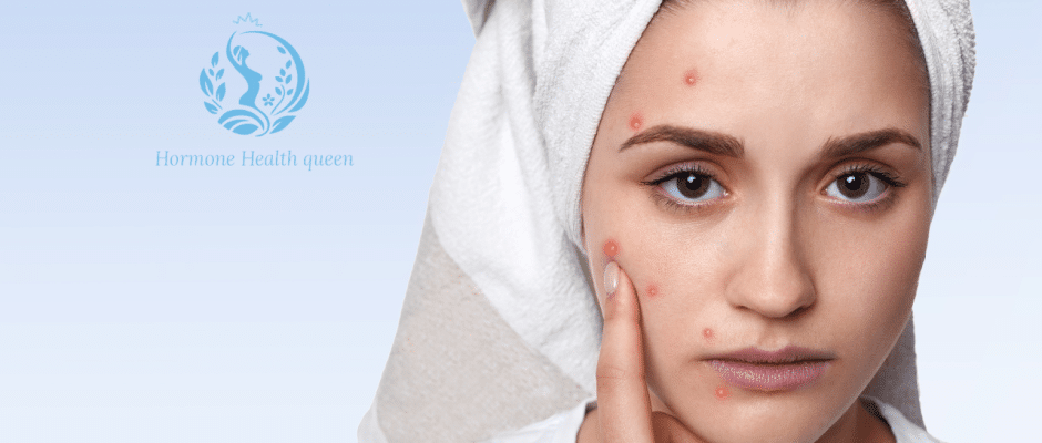 Why Your Skin Freaks Out in Spring—And How to Calm Hormonal Acne Fast