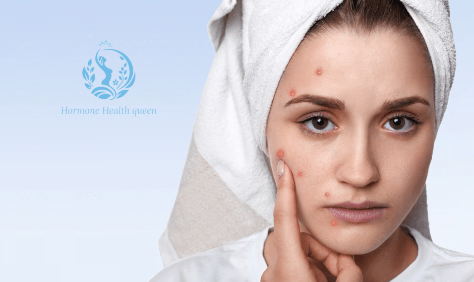 Why Your Skin Freaks Out in Spring—And How to Calm Hormonal Acne Fast