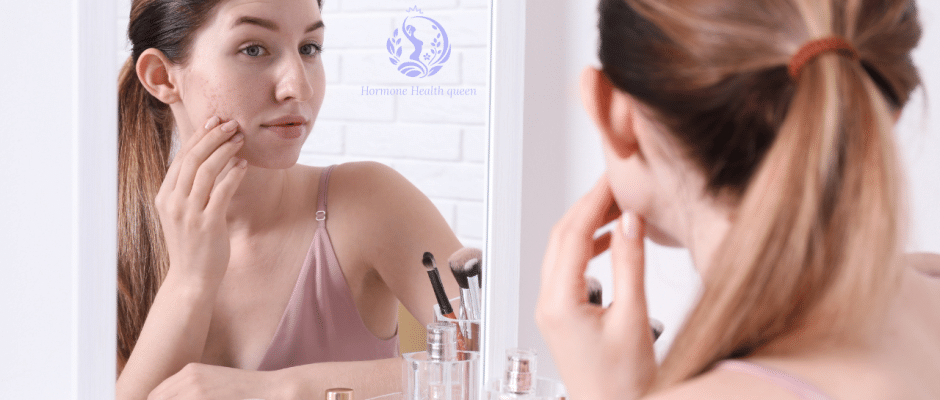 [2025 Guide] Hormonal Acne Treatment That Actually Works (No Harsh Chemicals)