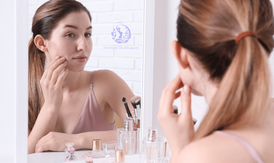 [2025 Guide] Hormonal Acne Treatment That Actually Works (No Harsh Chemicals)