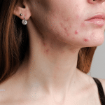 [Trending Vitamins] What’s Hot for Hormone Support in 2024