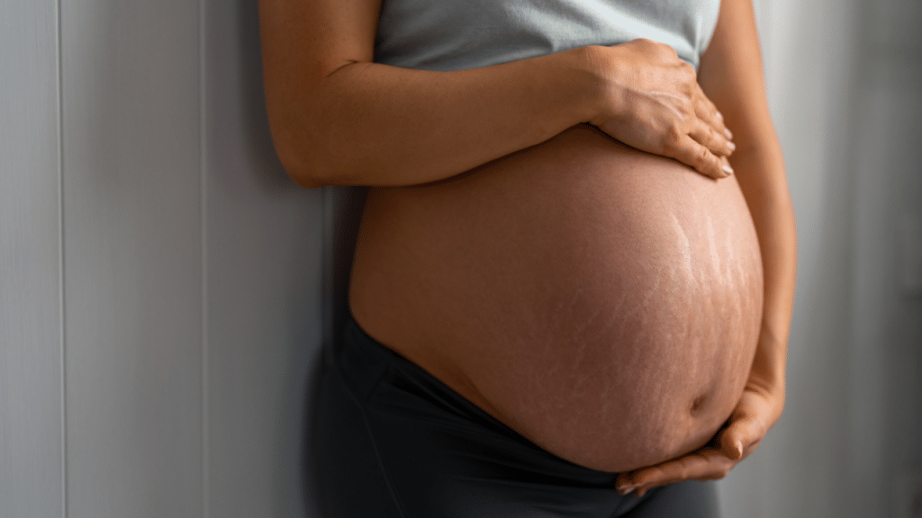 Most Common Pregnancy Skin Conditions