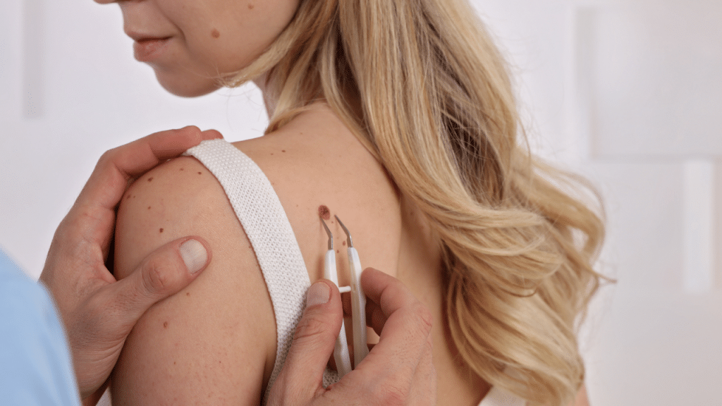 sudden skin tags appearance