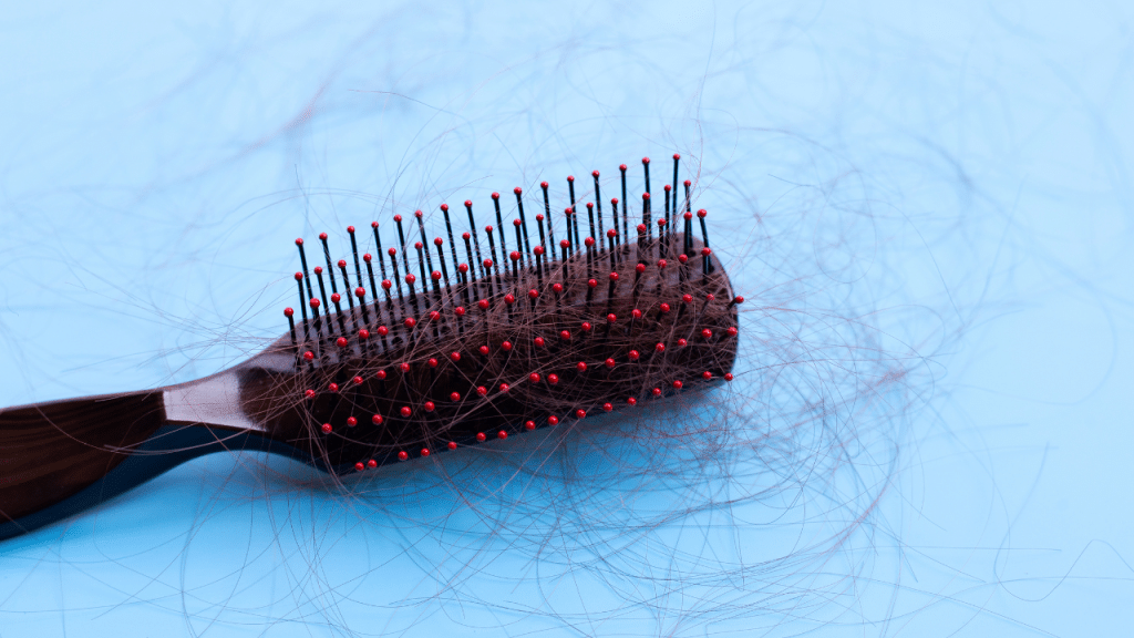 pcos symptoms: hair loss