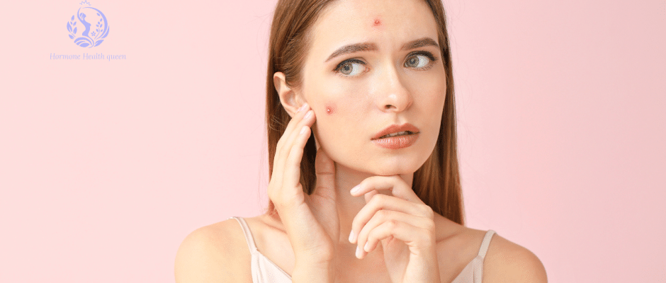 Pregnancy Breakouts? Here’s How to Soothe Hormonal Acne—Safely & Naturally