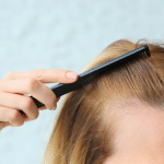 Postpartum Hair Loss: Ultimate Guide to Causes, Timeline & Best Treatments